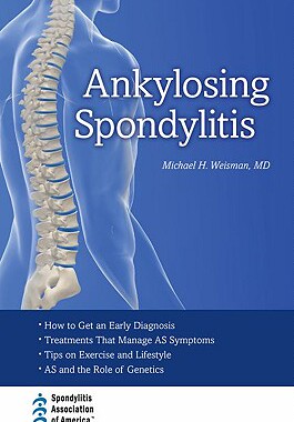 【预售】Ankylosing Spondylitis