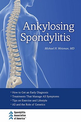 【预售】Ankylosing Spondylitis