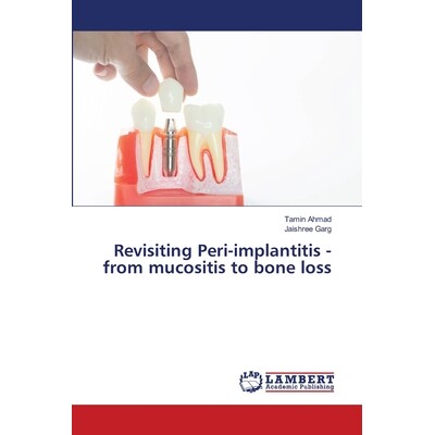 预订 Revisiting Peri-implantitis - from mucositis to bone loss: 9786207805563
