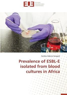 [预订]Prevalence of ESBL-E isolated from blood cultures in Africa 9783639730791