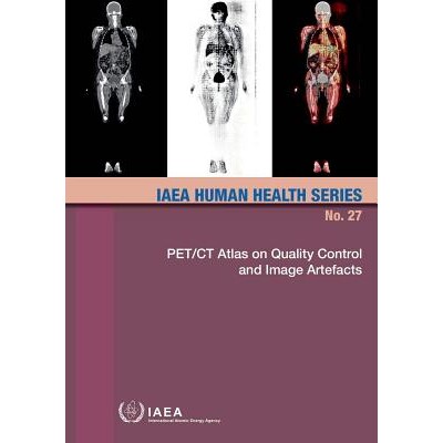 预订 PET/CT Atlas on Quality Control and Image Artefacts 关于质量控制和图像文物的PET / CT图谱: 9789201010148