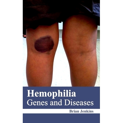 Genes and Diseases