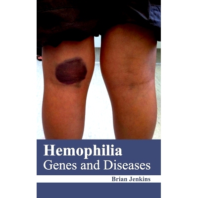 预订 Hemophilia: Genes and Diseases 血友病：基因和疾病: 9781632422279