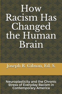 【预订】How Racism Has Changed the Human Brain: Neuroplasticity and the Chronic Stress of Everyday Racism in Conte...