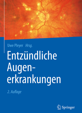 预订 Entzündliche Augenerkrankungen