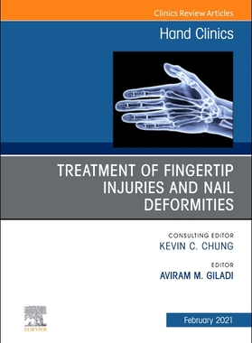【预订】Treatment of Fingertip Injuries and Nail Deformities, an Issue of Hand Clinics, 37