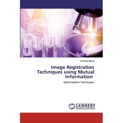 预订 Image Registration Techniques using Mutual Information: Optimization Techniques: 9786202525107