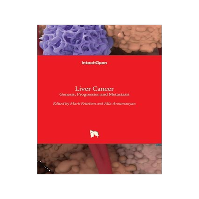 [预订]Liver Cancer - Genesis, Progression and Metastasis 9781803564135