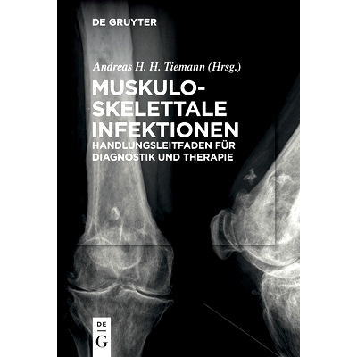预订 Muskuloskelettale Infektionen: Handlungsleitfaden für Diagnostik und Therapie: 9783110473155