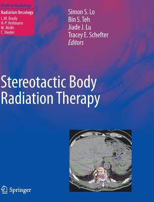 【预订】Stereotactic Body Radiation Therapy