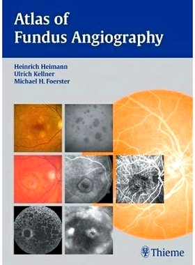 预订 Atlas of Fundus Angiography 眼底血管造影图集: 9783131405517