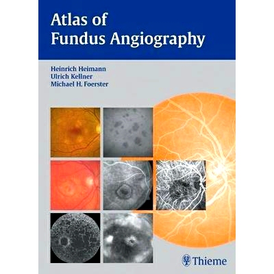 预订 Atlas of Fundus Angiography 眼底血管造影图集: 9783131405517