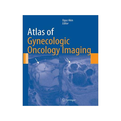 预订 Atlas of Gynecologic Oncology Imaging