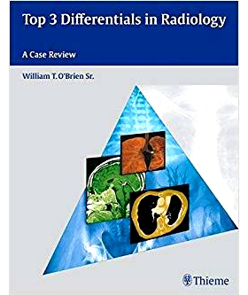 预订 Top 3 Differentials in Radiology: A Case Review 放射学上的3大差异: 9781604062267