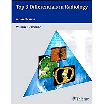 预订 Top 3 Differentials in Radiology: A Case Review 放射学上的3大差异: 9781604062267