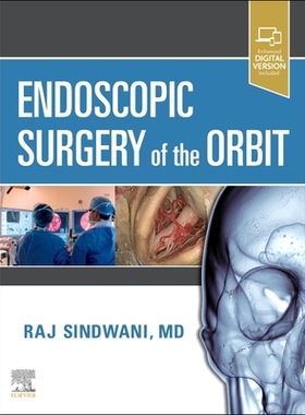 【预订】Endoscopic Surgery of the Orbit