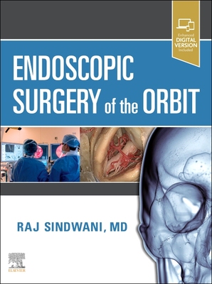 【预订】Endoscopic Surgery of the Orbit