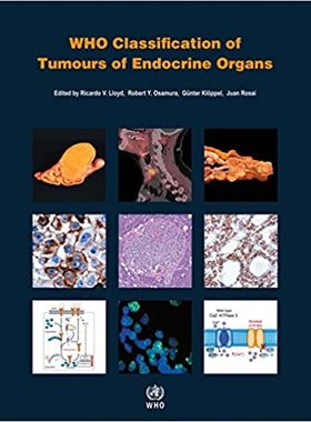 WHO Classification of Tumours of Endocrine Organs 9789283244936