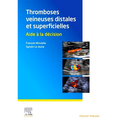 预订 Thromboses veineuses distales et superficielles : aide à la décision 远端和浅静脉血栓：决策支持: 9782294774652