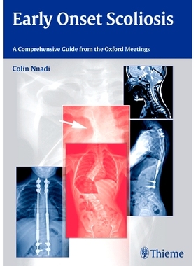 预订 Early Onset Scoliosis: A Comprehensive Guide from the Oxford Meetings 早期发病的脊柱侧凸: 9783131726612