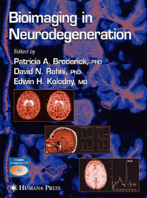 【预订】Bioimaging in Neurodegeneration