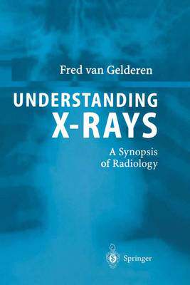 预订 Understanding X-Rays