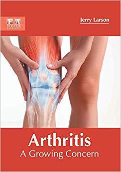 【预售】Arthritis: A Growing Concern