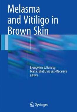 预订 Melasma and Vitiligo in Brown Skin