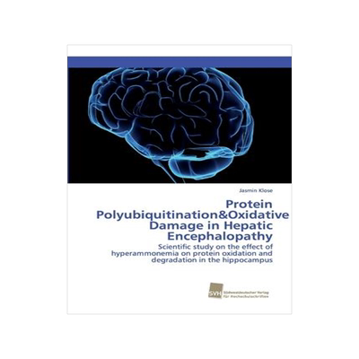 [预订]Protein Polyubiquitination&Oxidative Damage in Hepatic Encephalopathy 9783838152950