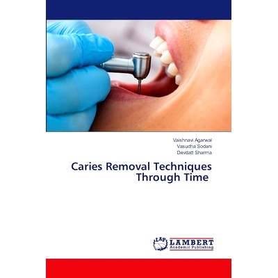预订 Caries Removal Techniques Through Time 跨越时间的龋齿去除技术: 9786207484287