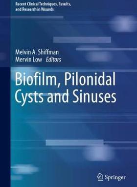 预订 Biofilm, Pilonidal Cysts and Sinuses