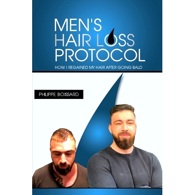 预订 Men’s hairloss protocol: How i regained my hair after going bald: 9798663916714
