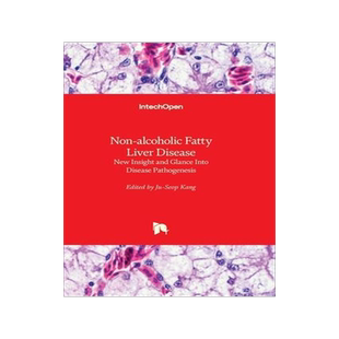 [预订]Non-alcoholic Fatty Liver Disease - New Insight and Glance Into Disease Pathogenesis 9781839680908