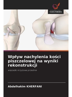 预订 Wplyw nachylenia kości piszczelowej na wyniki rekonstrukcji: 9786209410024