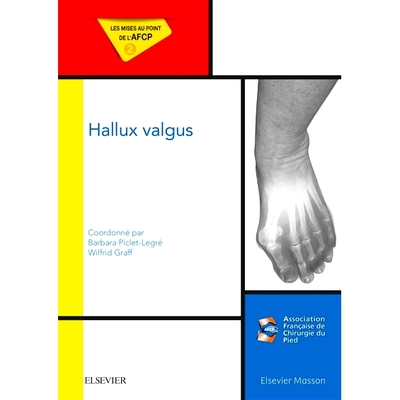预订 Hallux valgus 拇外翻: 9782294750663
