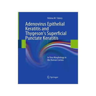 预订 Adenovirus Epithelial Keratitis and Thygeson’s Superficial Punctate Keratitis