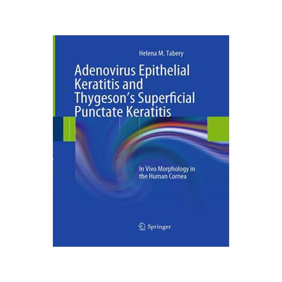 预订 Adenovirus Epithelial Keratitis and Thygeson’s Superficial Punctate Keratitis