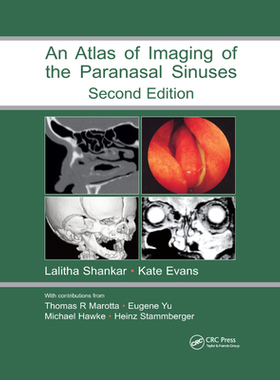 【预订】An Atlas of Imaging of the Paranasal Sinuses