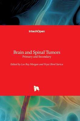 [预订]Brain and Spinal Tumors - Primary and Secondary 9781789841572