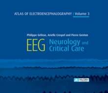 【预订】Atlas of Electroencephalography Volume 3: EEG Neurology and Critical Care (JOHN LIBBEY) 9782742015795