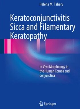 【预订】Keratoconjunctivitis Sicca and Filamentary Keratopathy