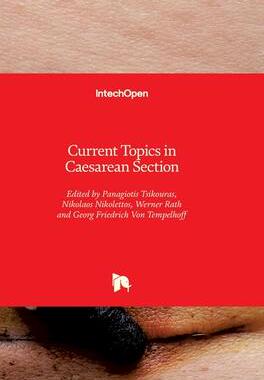 [预订]Current Topics in Caesarean Section 9781839691782