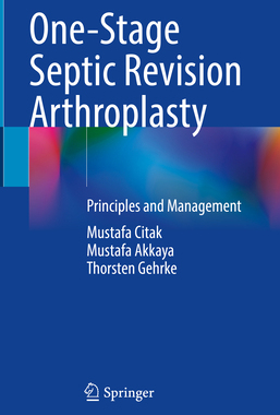 预订 One-Stage Septic Revision Arthroplasty