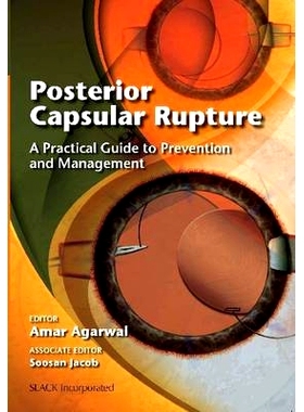 预订 Posterior Capsular Rupture: A Practical Guide to Prevention and Management 后囊破裂：预防和管理实用指南: 9781617110