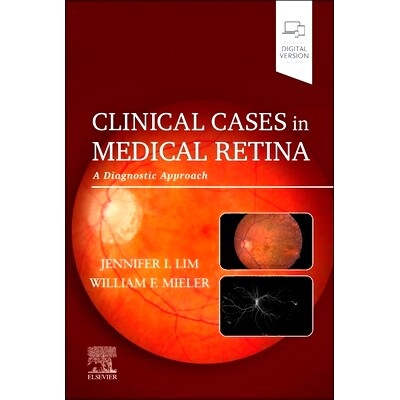 预订 Clinical Cases in Medical Retina: A Diagnostic Approach 医学视网膜临床病例：诊断方法: 9780128227206