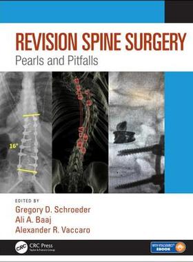 【预订】Revision Spine Surgery: Pearls and Pitfalls