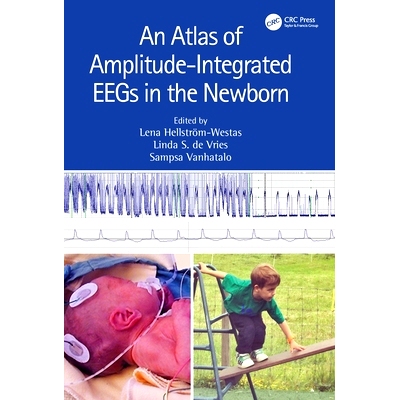 预订 An Atlas of Amplitude-Integrated EEGs in the Newborn 新生儿振幅整合脑电图谱 第3版: 9781032258508