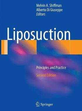 【预订】Liposuction