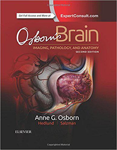 预售 Osborn’s Brain 大脑 书籍/杂志/报纸 原版其它 原图主图