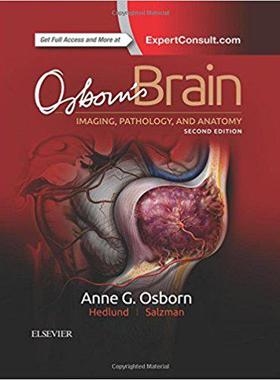 预售 Osborn’s Brain 大脑